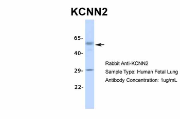 KCNN2 antibody