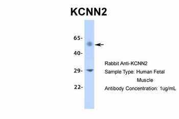 KCNN2 antibody