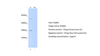 KCNN2 antibody
