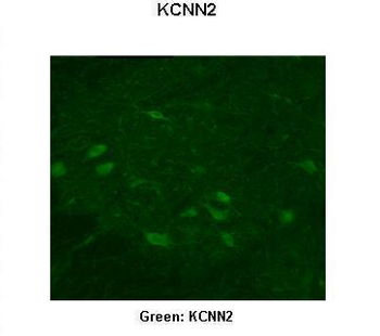 KCNN2 antibody