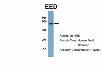 EED antibody
