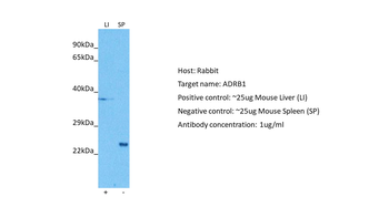 beta 1 Adrenergic Receptor antibody