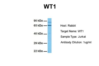 WT1 antibody