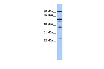 EZH1 antibody