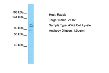 ZEB2 antibody