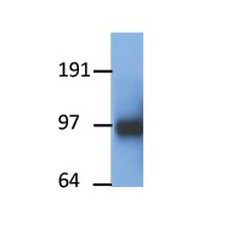 Ppargc1a antibody