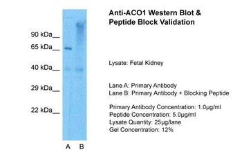 ACO1 antibody