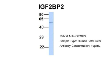 IGF2BP2 antibody