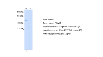 FBXW2 antibody