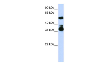 FBXW2 antibody