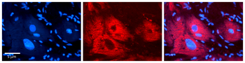 EXT2 antibody