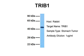 TRIB1 antibody