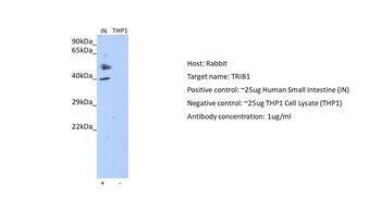 TRIB1 antibody