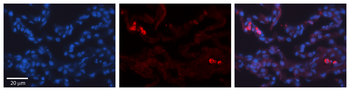 TRIB1 antibody