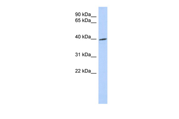 TRIB1 antibody