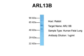 ARL13B antibody