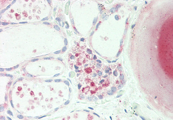 PDE1A antibody