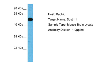 SQSTM1 antibody