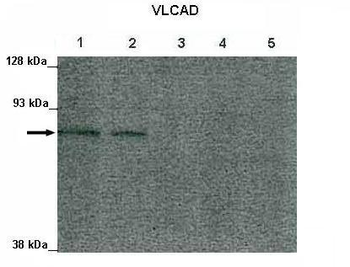 ACADVL antibody