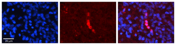 ACADVL antibody