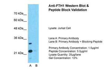 FTH1 antibody