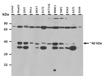 MTNR1B Rabbit Polyclonal Antibody