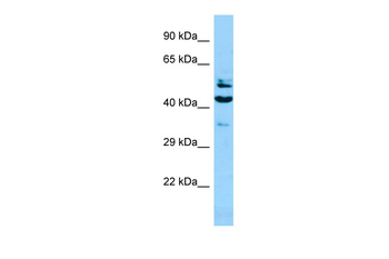 SH2D4A antibody