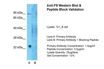 Factor VIII antibody