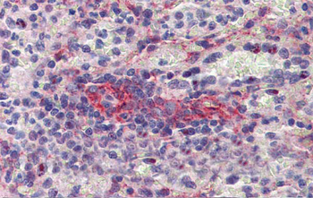 SEPT11 antibody