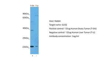 GLIS2 antibody