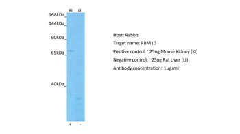 RBM10 antibody