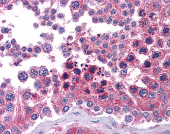 STAT6 antibody