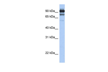 STAT6 antibody