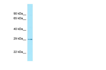 CDX2 antibody