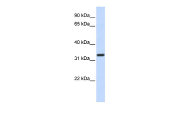 Nkx2-5 antibody