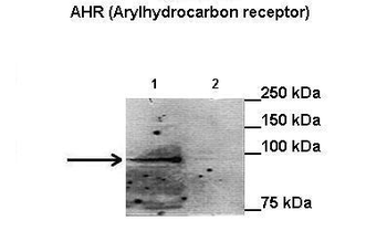 AHR antibody