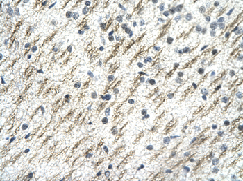 SSBP2 antibody