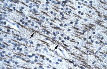 SSBP2 antibody