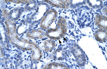 SSBP2 antibody