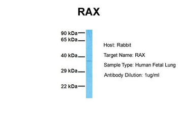 RAX antibody