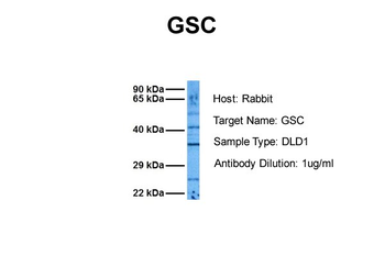 GSC antibody