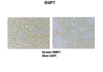 Bmp7 antibody