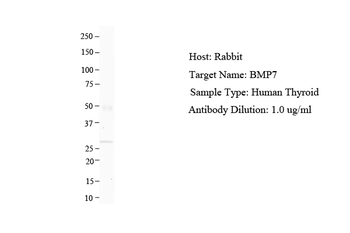 BMP7 antibody