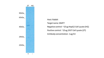BMP7 antibody