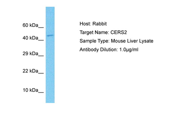 LASS2 antibody