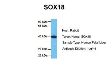 SOX18 antibody