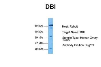 DBI antibody