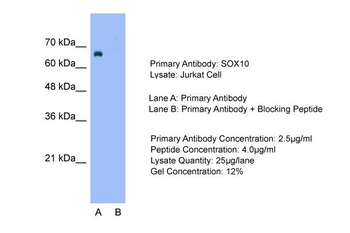 SOX10 antibody