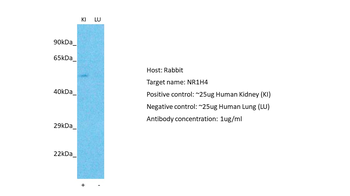 NR1H4 antibody