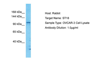 ST18 antibody